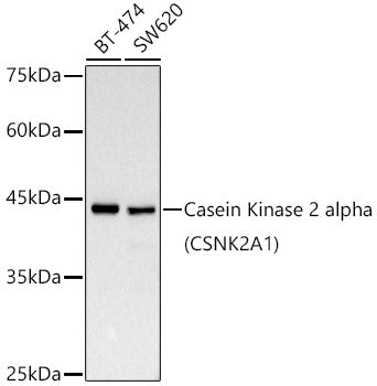 [KD Validated] Casein Kinase 2 alpha (CSNK2A1) Rabbit mAb