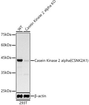[KD Validated] Casein Kinase 2 alpha (CSNK2A1) Rabbit mAb