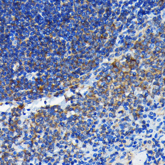[KO Validated] Bax Rabbit mAb
