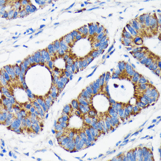 [KO Validated] Bax Rabbit mAb