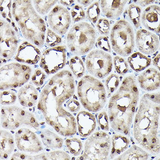 Ubiquitin Rabbit mAb