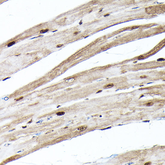Ubiquitin Rabbit mAb