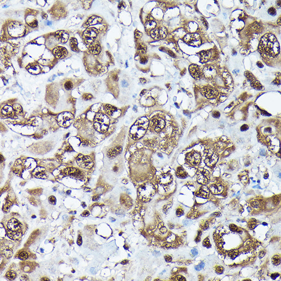Ubiquitin Rabbit mAb