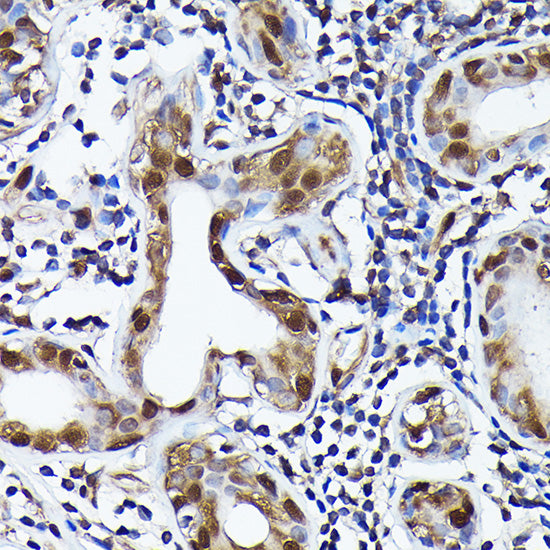 Ubiquitin Rabbit mAb