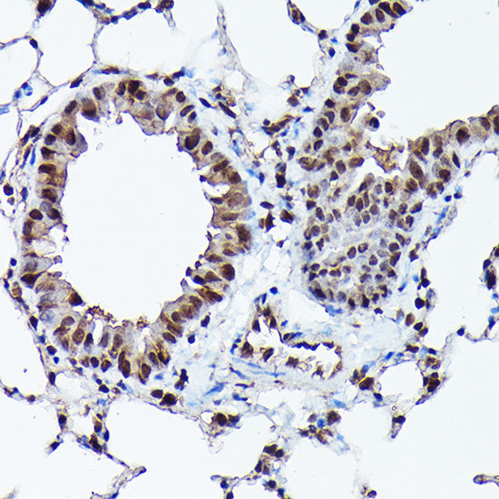 Ubiquitin Rabbit mAb