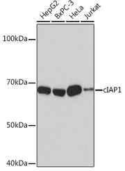 [KO Validated] cIAP1 Rabbit mAb
