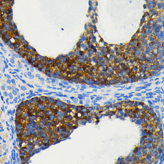 [KO Validated] cIAP1 Rabbit mAb