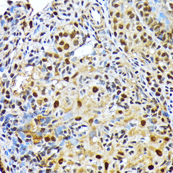ENT2/SLC29A2 Rabbit mAb