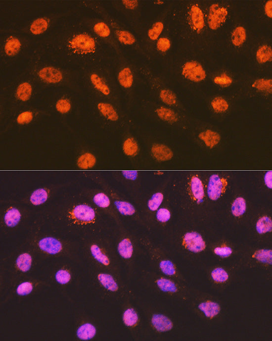 ENT2/SLC29A2 Rabbit mAb