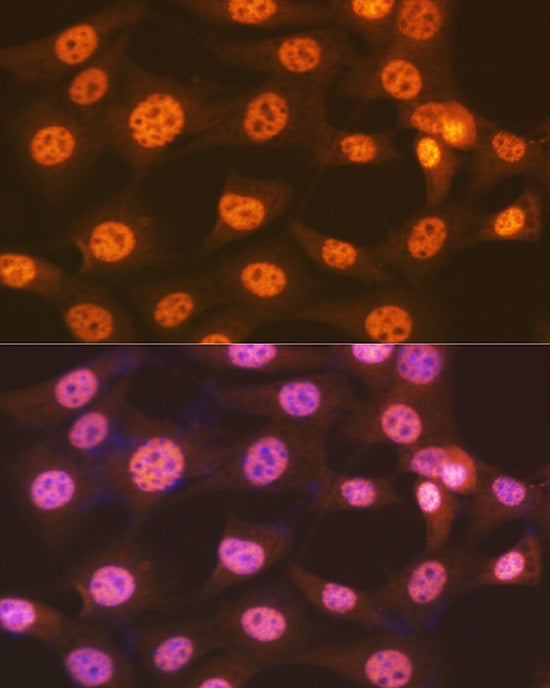 ENT2/SLC29A2 Rabbit mAb