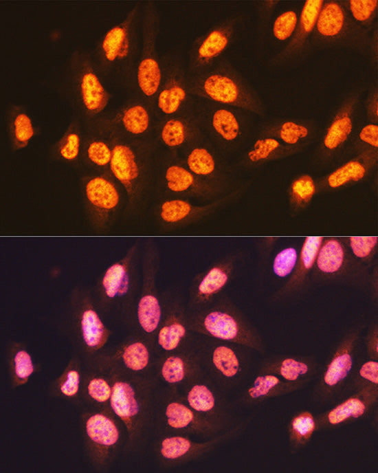 ENT2/SLC29A2 Rabbit mAb