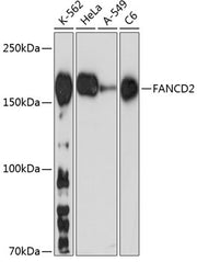 FANCD2 Rabbit mAb