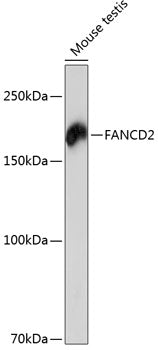 FANCD2 Rabbit mAb