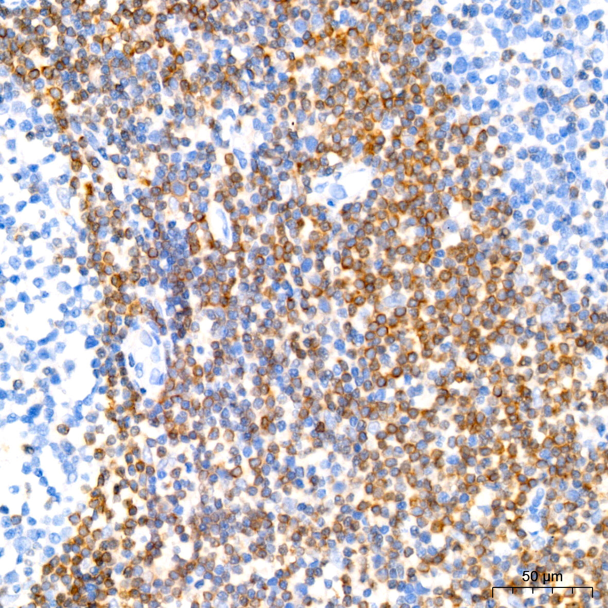[KD Validated] Bcl-2 Rabbit mAb
