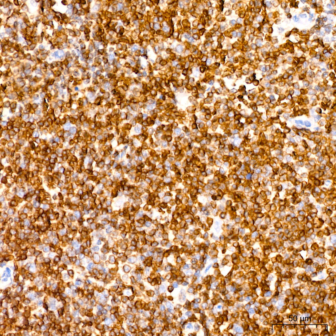 [KD Validated] Bcl-2 Rabbit mAb