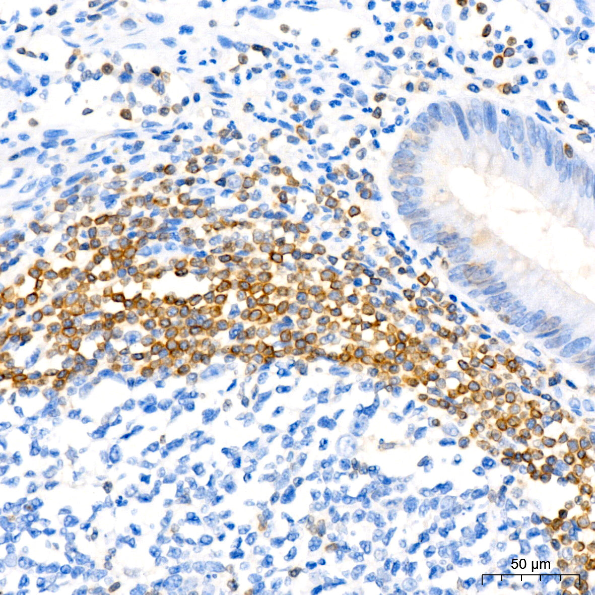 [KD Validated] Bcl-2 Rabbit mAb
