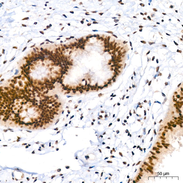 PIM1 Rabbit mAb
