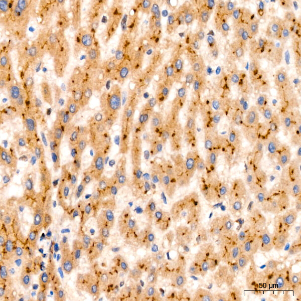 PIM1 Rabbit mAb