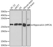 Hippocalcin (HPCA) Rabbit mAb