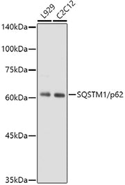 SQSTM1/p62 Rabbit mAb