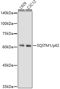 SQSTM1/p62 Rabbit mAb