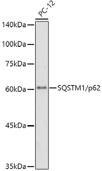 SQSTM1/p62 Rabbit mAb