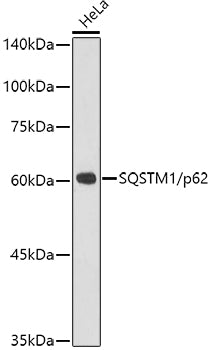 SQSTM1/p62 Rabbit mAb
