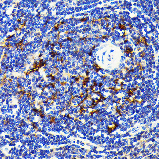 SQSTM1/p62 Rabbit mAb