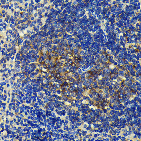 SQSTM1/p62 Rabbit mAb