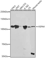 HSPA4 Rabbit mAb