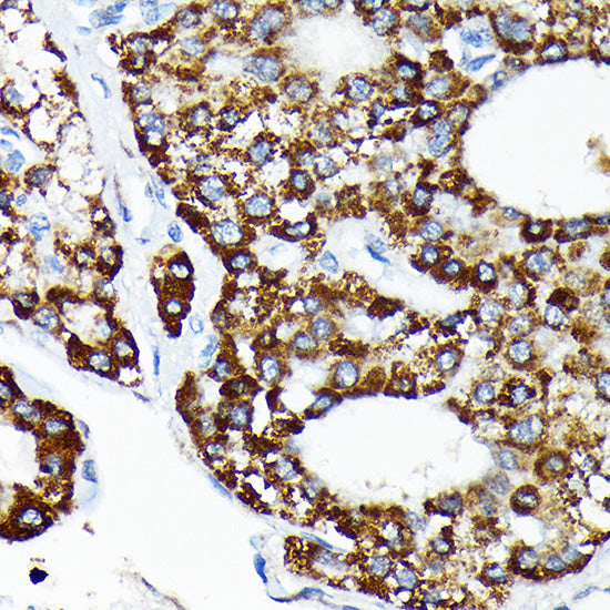 HSPA4 Rabbit mAb