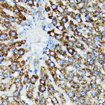 HSPA4 Rabbit mAb