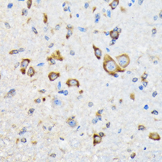 HSPA4 Rabbit mAb