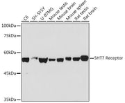 5HT7 Receptor Rabbit mAb