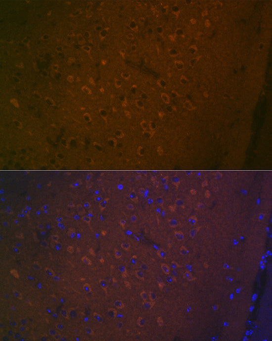 5HT7 Receptor Rabbit mAb