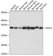 VDAC1 Rabbit mAb