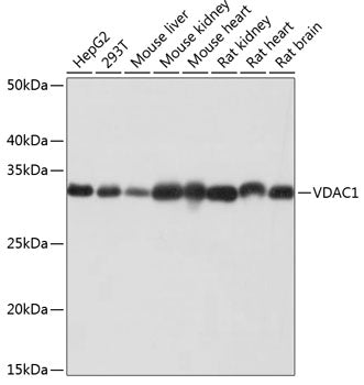 VDAC1 Rabbit mAb