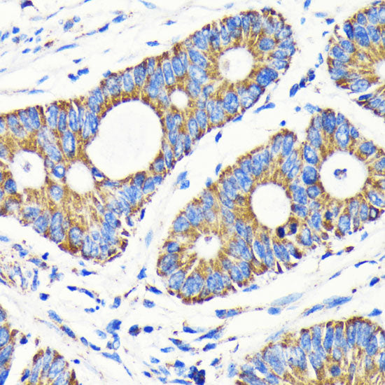 VDAC1 Rabbit mAb