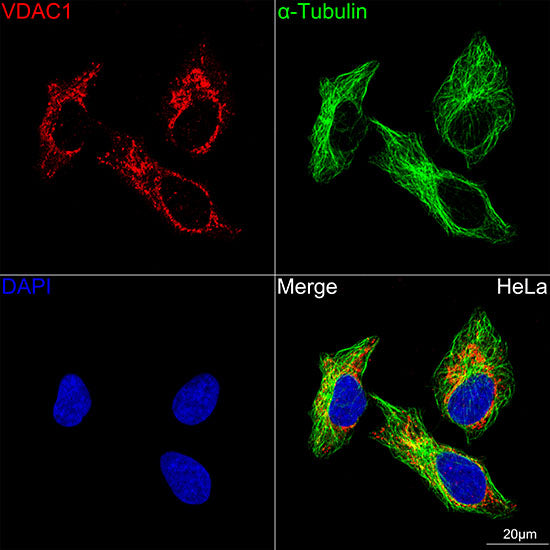 VDAC1 Rabbit mAb