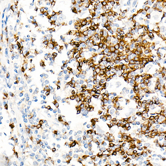 IGHD Rabbit mAb