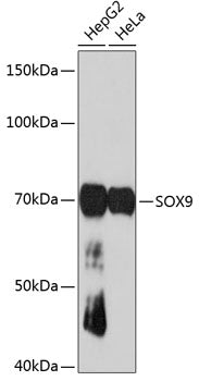 SOX9 Rabbit mAb