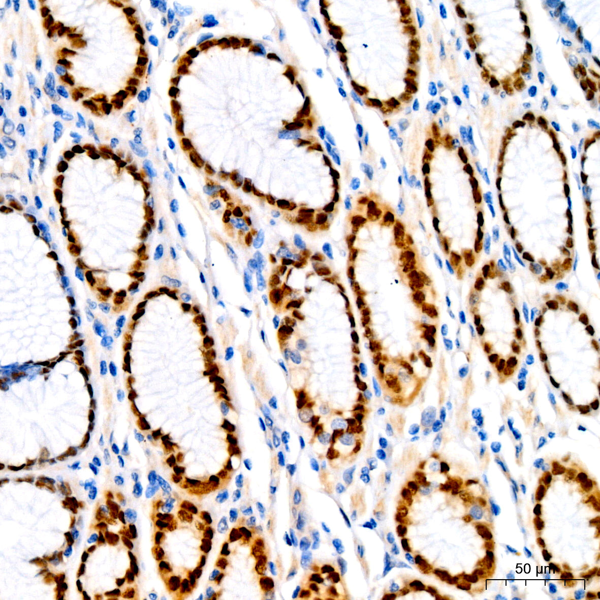 SOX9 Rabbit mAb