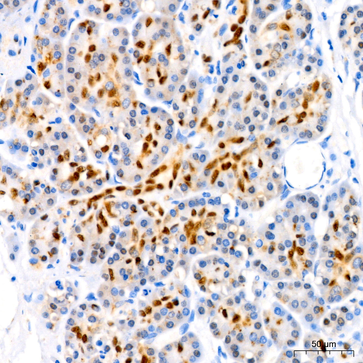 SOX9 Rabbit mAb