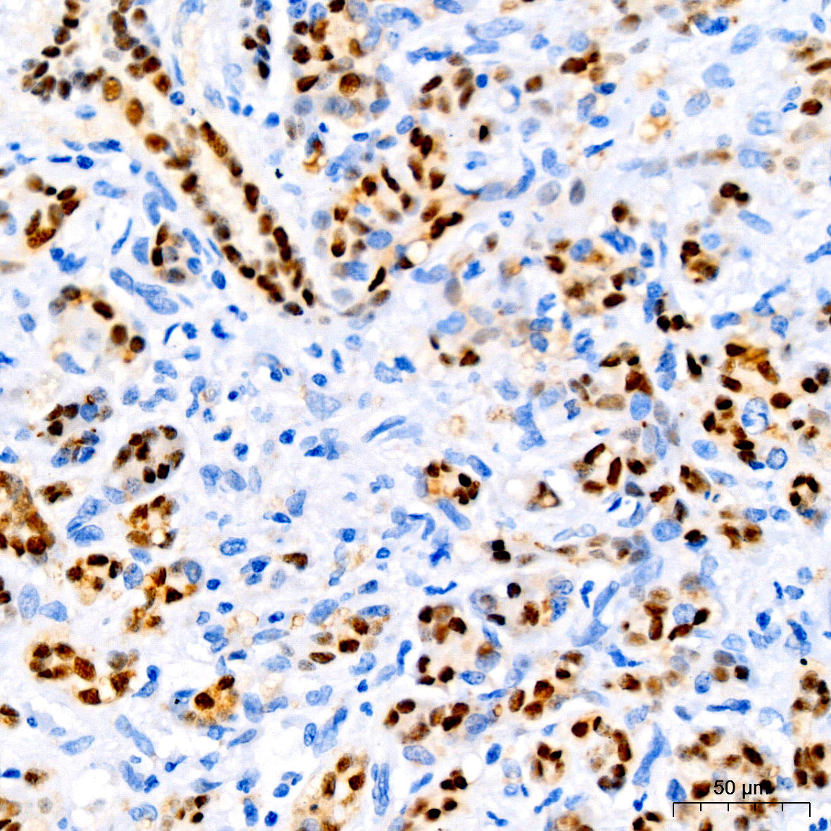 SOX9 Rabbit mAb