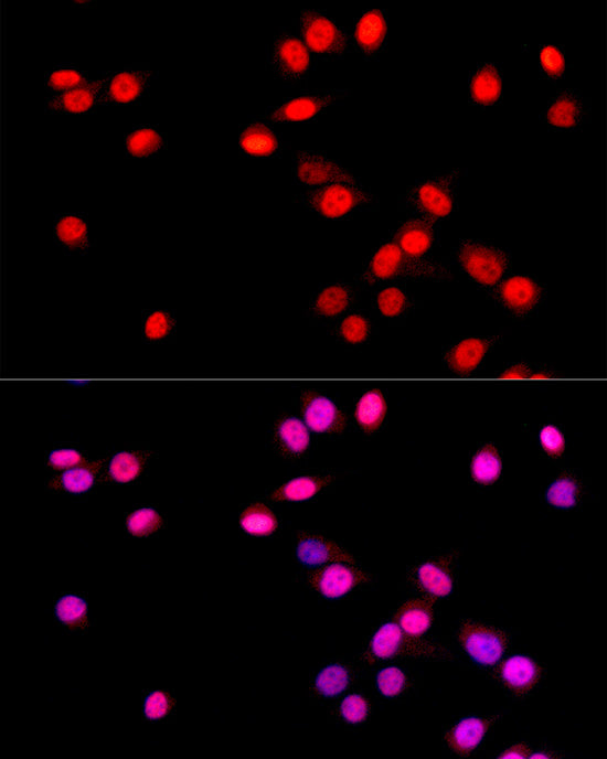SOX9 Rabbit mAb
