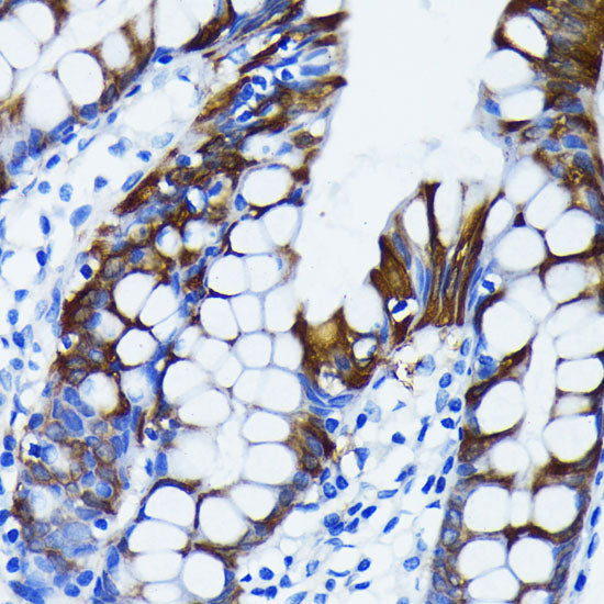 IκBα Rabbit mAb