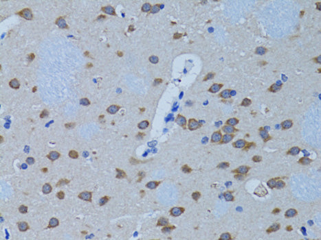 PLCB1 Rabbit pAb