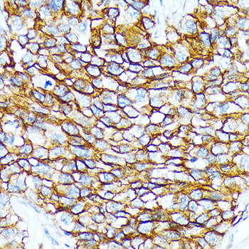 CD239/BCAM Rabbit mAb