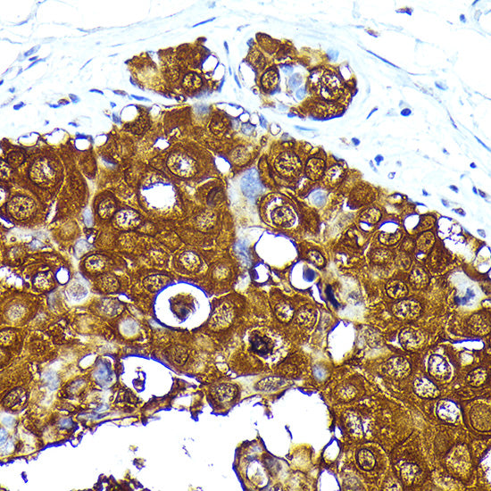 Mammaglobin A Rabbit mAb