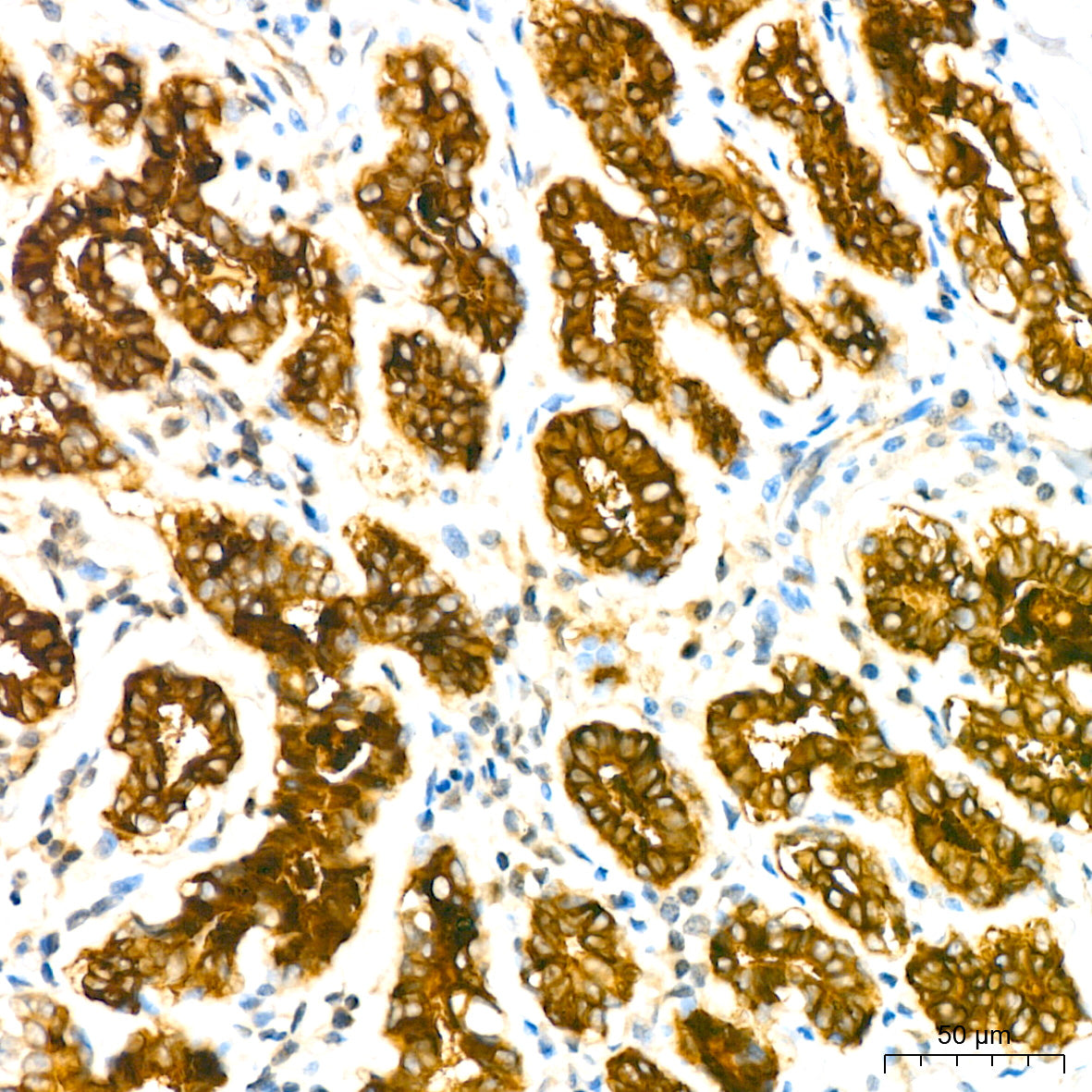 Mammaglobin A Rabbit mAb